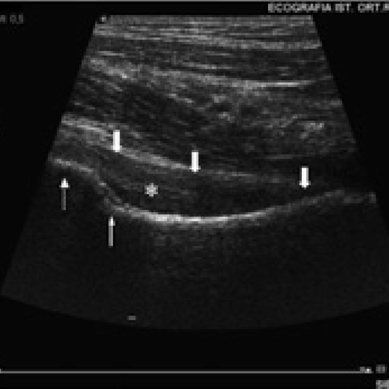 Ultrasound Hip Joint Test